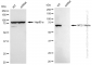 KD-Validated Anti-NF2 / Merlin Rabbit Monoclonal Antibody